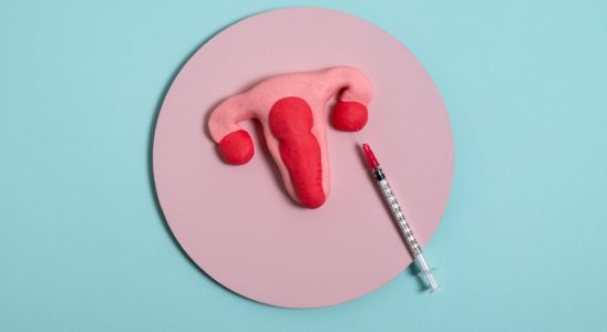 Leucoplazia genitală cu transmitere sexuală