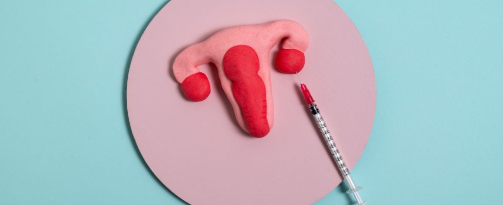 Leucoplazia genitală cu transmitere sexuală
